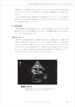 増刊 レジデントノート 循環器診療の疑問、これで解決 レジデントノート増刊：循環器診療の疑問、これで納得